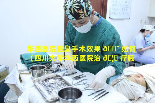 华西医院腋臭手术效果 🐯 如何（四川大学华西医院治 🦍 疗腋臭效果好吗）